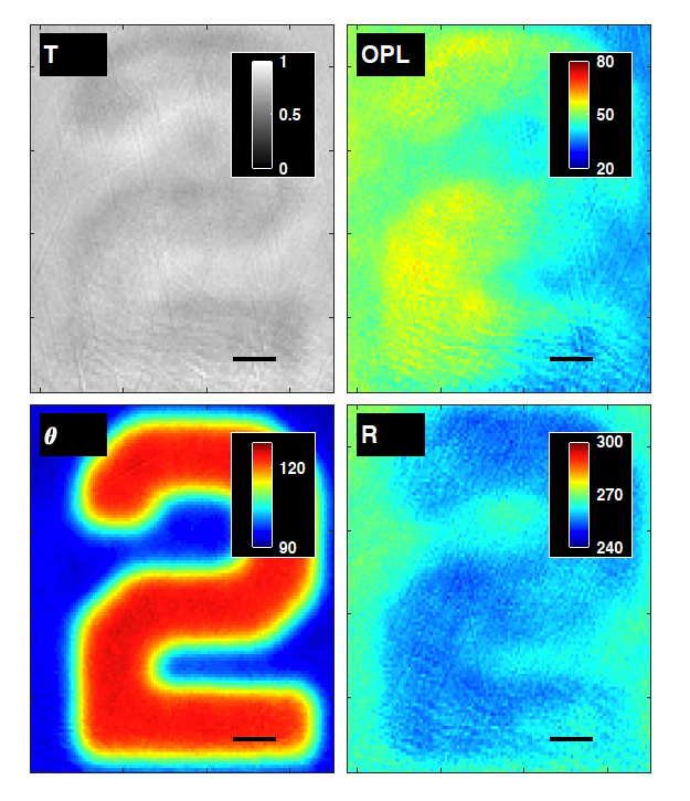 PFerrandFresnel's tweet image. This precise knowledge of the actual probes clearly improves the reconstruction of the object and of its optical properties. #QuantitativeImaging