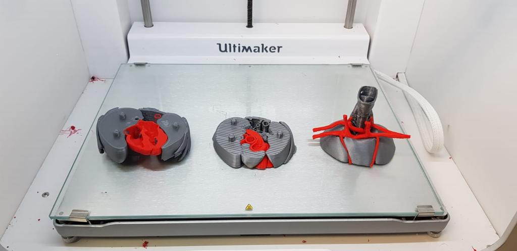 sandrasv97's tweet photo. 3D model representing a fetus' thorax to help Dr. León conduct a course for residents. This model  shows one of the most common cardiopathys in fetus. This proyect was accomplish by the FabLab team at HGUGM @3d_maranon @rupermac @calvoharo_ja @diegotrap @kn_ord @sandrasv97 https://t.co/GZn5eQ71fk