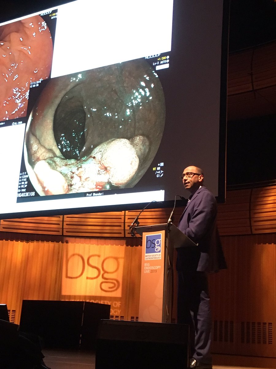 #BSGEL2019 Pradeep Bhandari superb exposition on what needs biopsies and what does not: seek and ye shall find!