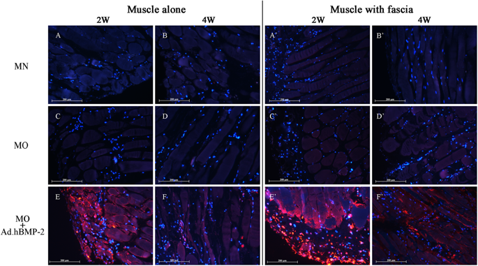 GeneTherapy_SN's tweet image. Tissue culture models of muscle implants benefit from the fascia layer by the improved delivery of BMP-2. This could help to optimize the osteo-regenerative tissue grafts &amp;amp; contribute to the development of gene-enhanced #boneengineering technologies.
ow.ly/gqZg50mFF3S
