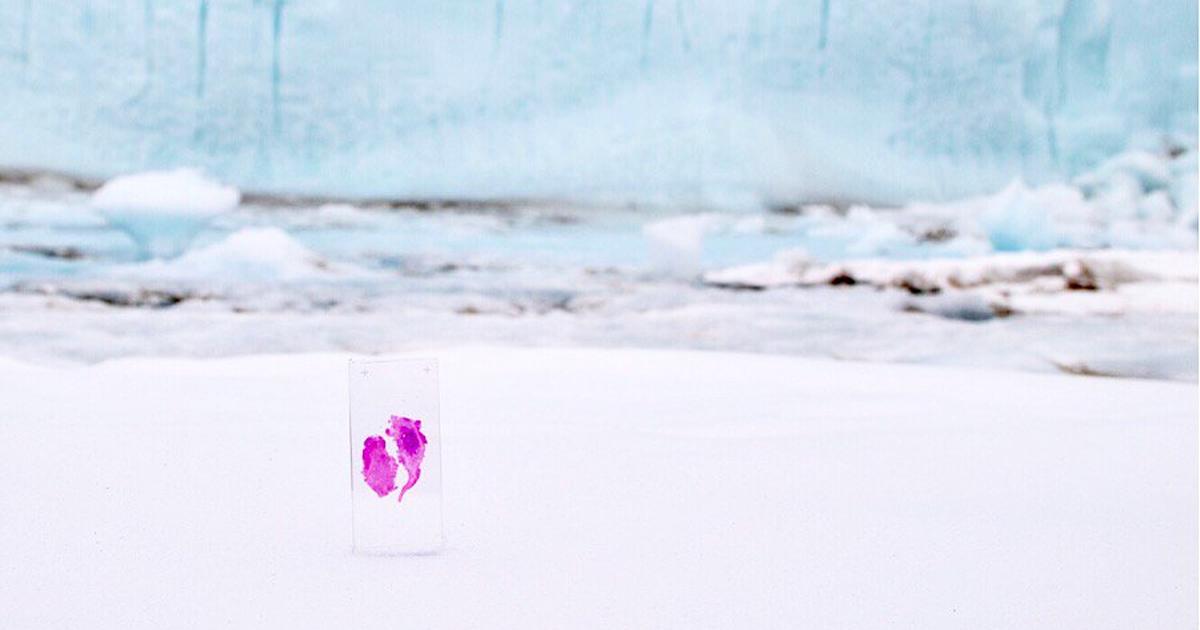 danielensing's tweet photo. Simone Giertz sent her removed brain tumor to Antarctica https://t.co/z7VJqnLOES https://t.co/HbM2SoilaO