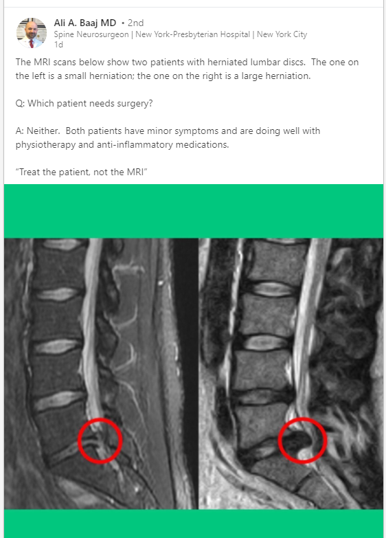 ashjamesphysio's tweet photo. Very refreshing to see from a surgeon on LinkedIn 👍👌 https://t.co/lavDwj6v8V