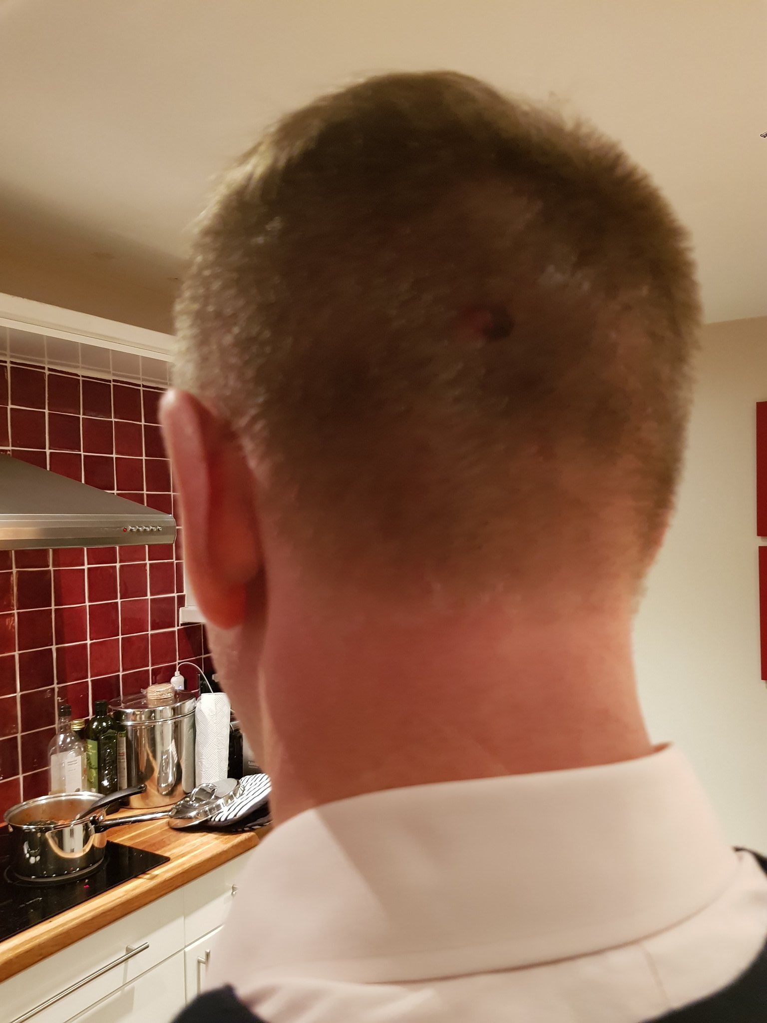 Chris Bryant on X: I've just found a photo we took of my dodgy mole which  turned out to be a melanoma. My hair isn't normally that short  @MelanomaUK  / X