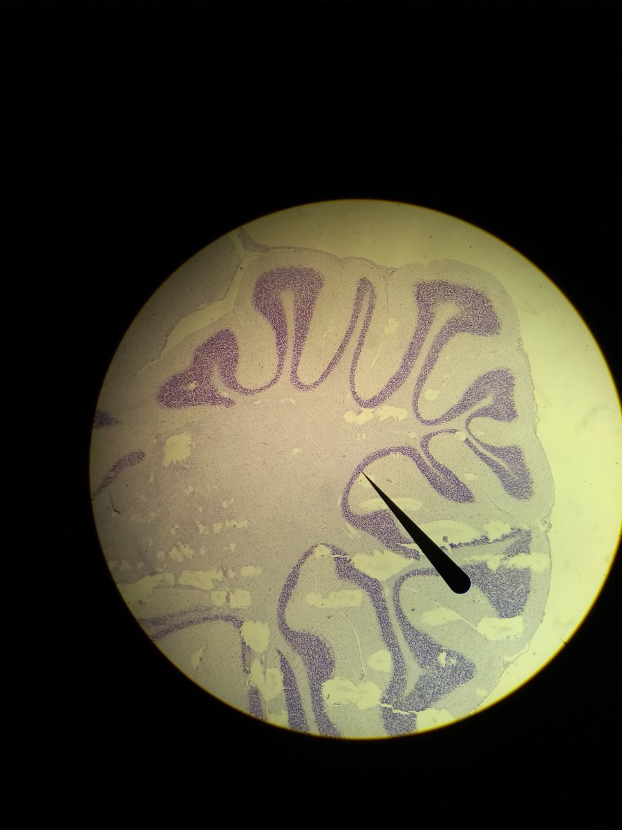 FilhodeWerther's tweet photo. Facul de agronomia e oq mais curti foi ver cérebro de rato no microscópio... https://t.co/0iY42kacoY