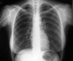 Formalviz's tweet photo. 📌#Cursoonline de #RadiografíadeTórax para #Medicos 
🎉🎉NOVEDAD🎉🎉
Duración: 120 horas lectivas
Acreditación: 7.5 créditos de la CFC de las profesiones sanitarias de la Comunidad de Madrid, válidos en todo el territorio nacional
⬇️⬇️⬇️
https://t.co/hPVn0KwnFM https://t.co/RSWid3xMNr