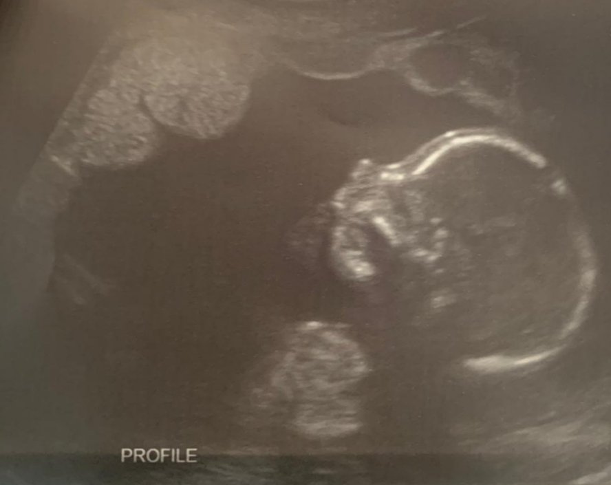 Hey everyone, look at the beautiful artwork my daughter &amp; son-in-law created! #grandparents