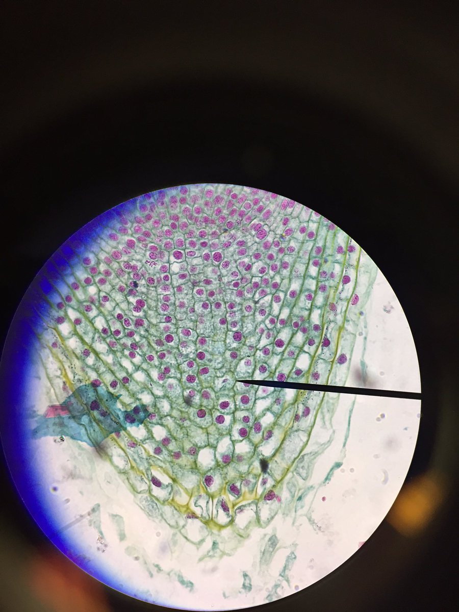 JustinBarenber3's tweet photo. @UNKBiol106   #106Week9PTS19
Seeing the phases of mitosis under the microscope in lab this week was pretty neat. https://t.co/TvBHRPinM3