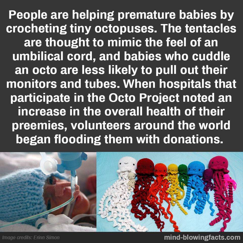 RockofLifeNI's tweet photo. #octoproject 👣🐙 #TinyLivesMatter #ProLife #BABYLIVESMATTER https://t.co/Wyo2x26p9s
