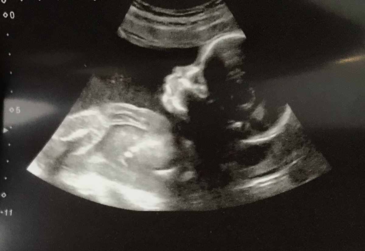 Girlaboutfarm's tweet photo. We tupped an extra one this year...the reason I’ve been a bit quiet on here. Focusing on growing this little one! #ramorewe is the question! https://t.co/8jLX86tHH3