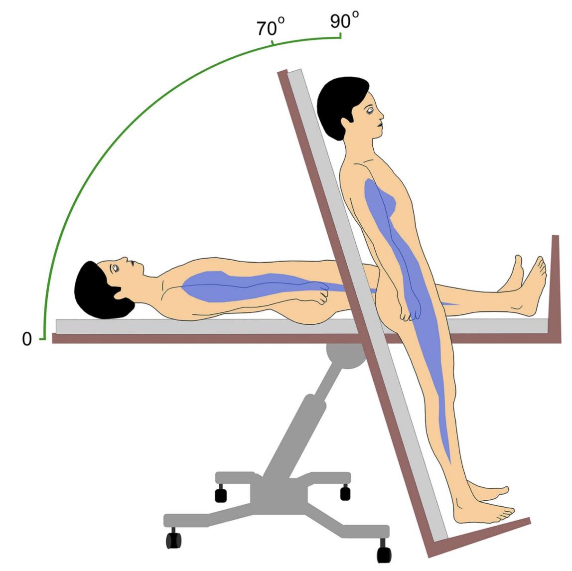 Dysautonomia's tweet photo. A great history and review of tilt testing from Dr. Cheshire &amp; Dr. Goldstein. https://t.co/xq0GmKL8UW https://t.co/xXzcXL8JDa