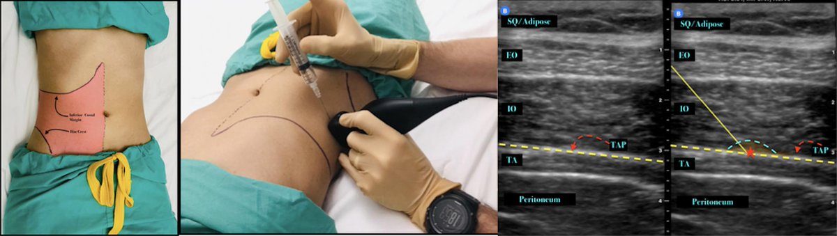 Pain Profiles tweet media