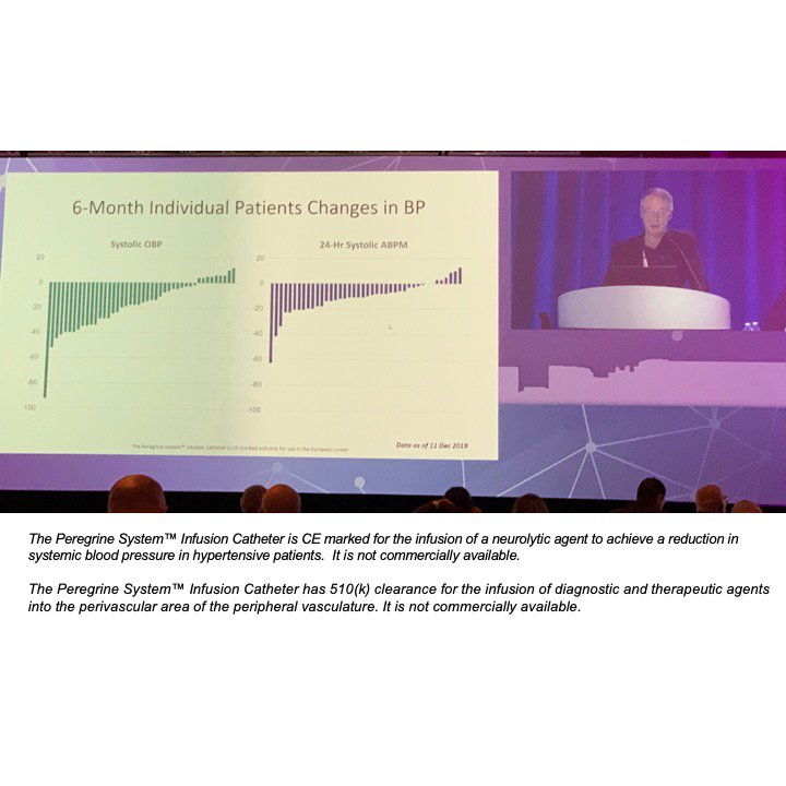 Prof. Horst Sievert presented Peregrine Post-Market study results for the CE-marked Peregrine Catheter at #CRT2019 on behalf of European investigators.  tinyurl.com/y2an489p