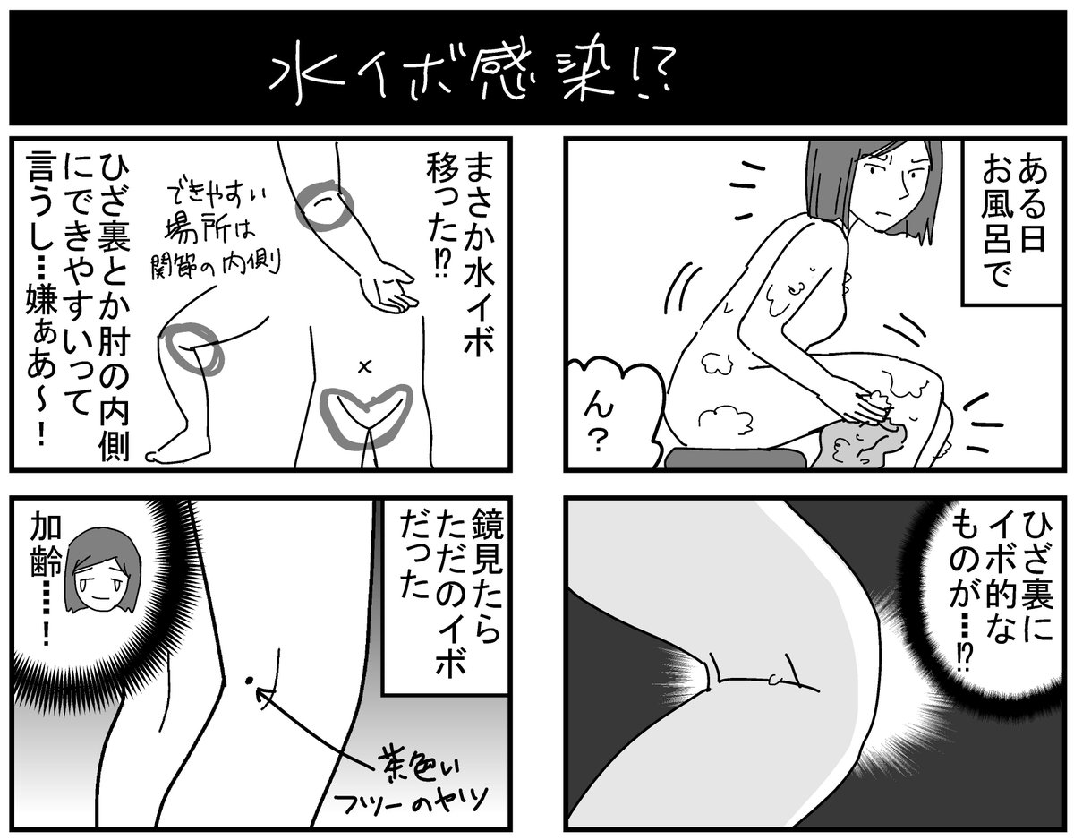 お騒がせ水イボ(わたし編)。
ちなみに首にもあったけど、これもよく見たらただのイボでした。
加齢~~~~~!?
#育児漫画 #エッセイ漫画