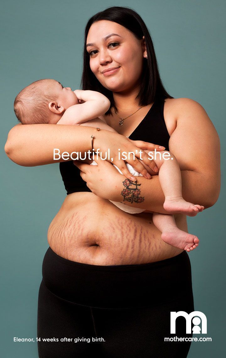 Campaignmag's tweet photo. Parenting retailer @Mothercare is championing post-birth bodies in an ad campaign that breaks stereotypes about new mums: https://t.co/2xlCLeKJW2 https://t.co/bqmQIrJRKW
