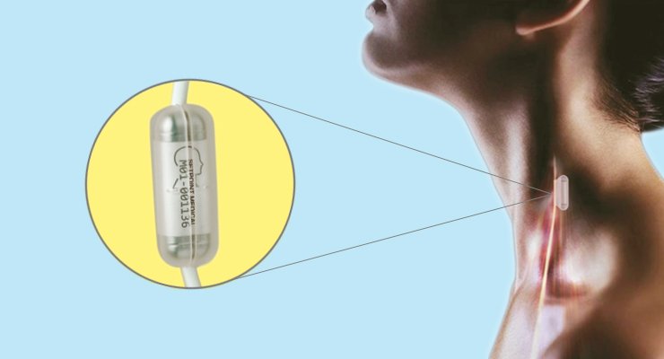brain_2020's tweet photo. #Tissue_Science_2019
The next level of leveraging the body’s potential and treating diseases using #Bioelectronics
Register today to meet the global experts in the field of #Biomedical.
🔗https://t.co/tjwcAo1bPR
#Bio_engineering #Biomedical_devices @ISTM_Keele @wtccmr @Yale @UL https://t.co/J79RYMc6SI
