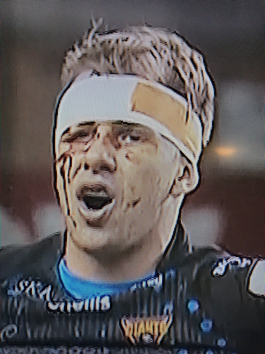 ChrisAtArrow's tweet photo. Fabulous Effort from the Giants Hope the knocks heal quickly Boys amazing determination https://t.co/RFcC3RSOtJ