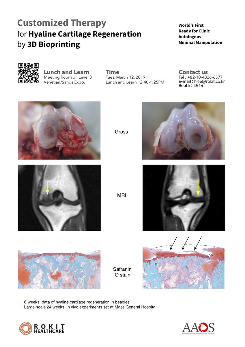 Cartilage Regeneration Platform is Ready. Please Check Before &amp; After.