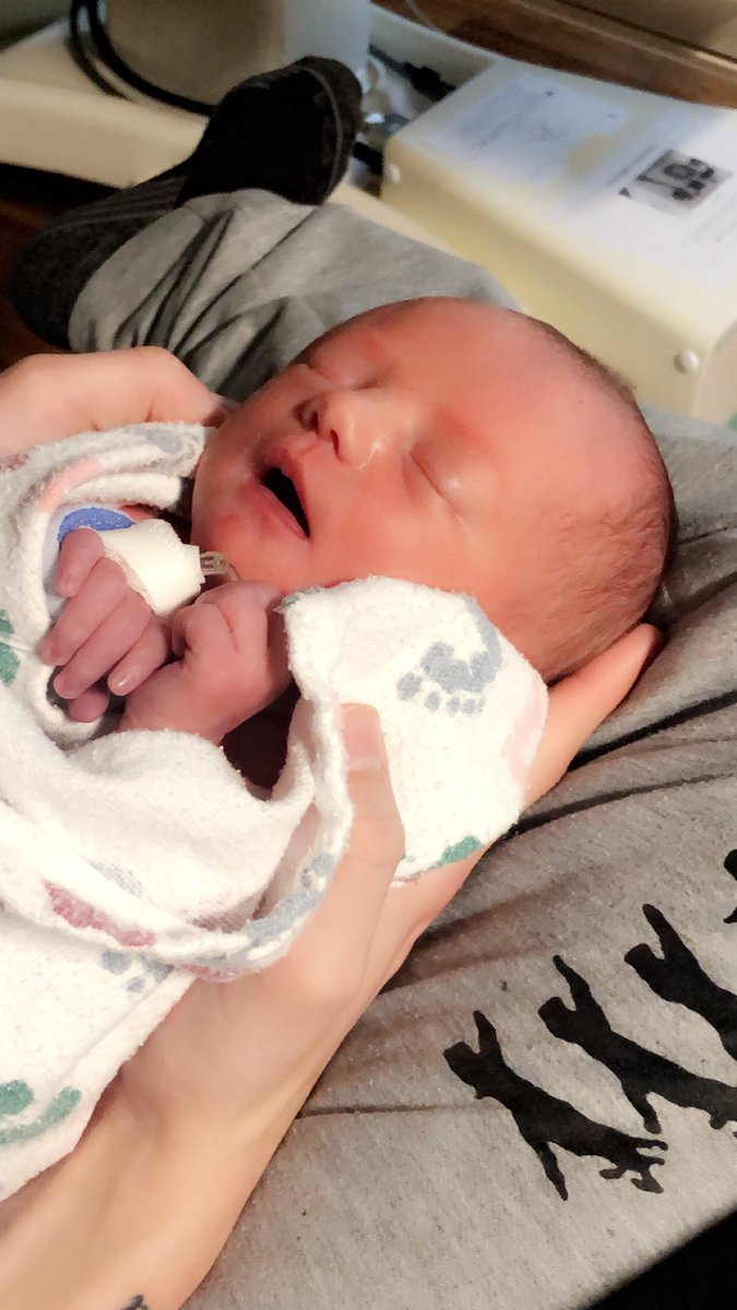 Quith__'s tweet image. Amelia without the oxygen and feeding tube 😍🥰🥰💗