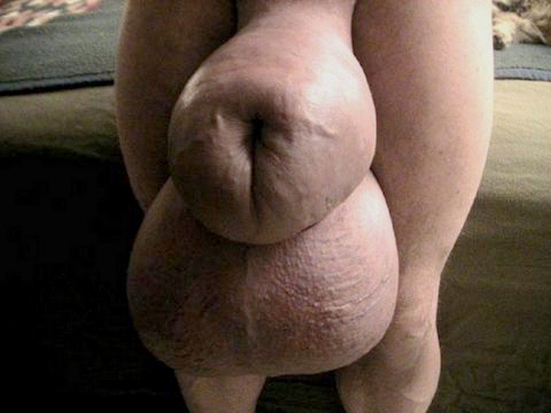 Huge Morphed Cock And Balls Datawav Nude Picture.