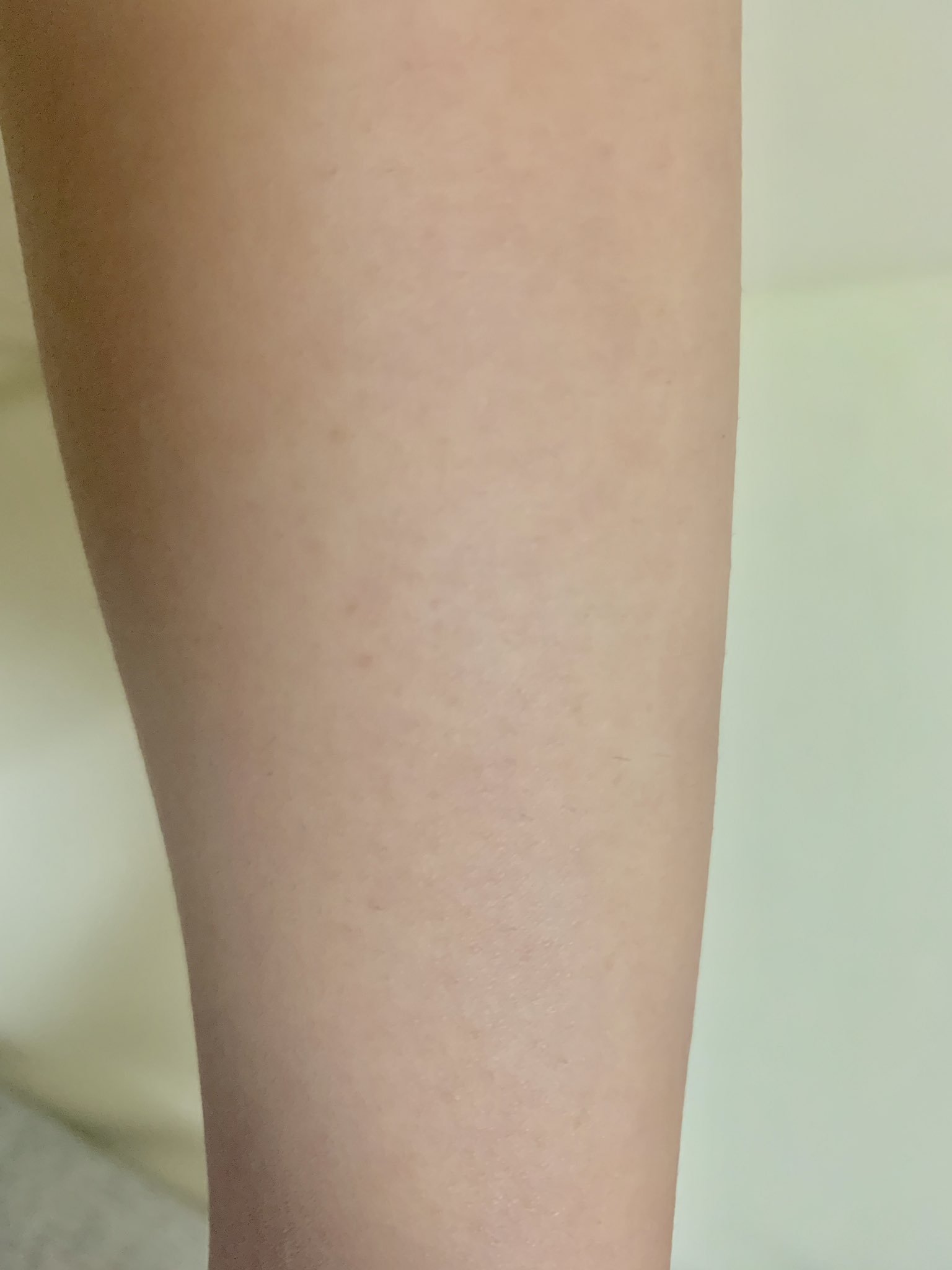 ブランクリニック割引 全国どこでも2万円割引 Blancclinic Twitter