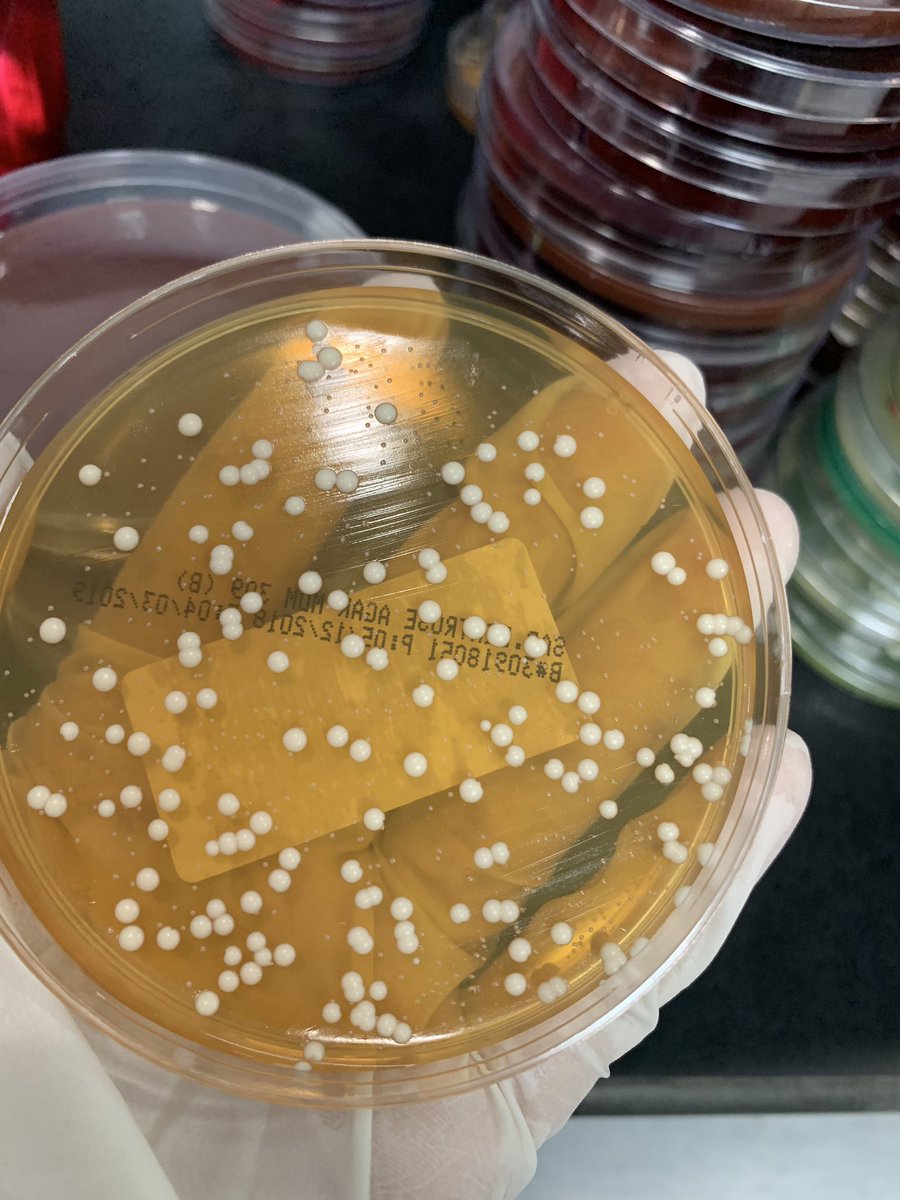 صورة اليوم من لاب المايكرو 🥁
عينة ال High vaginal swab (HVS)
بنزرعها على ال(SDA) Sabouraud Dextrose Agar عشان نشوف هل فيه Candida والا ؟ 🤔
وهذا شكلها اذا كانت موجودة 💁🏻✨