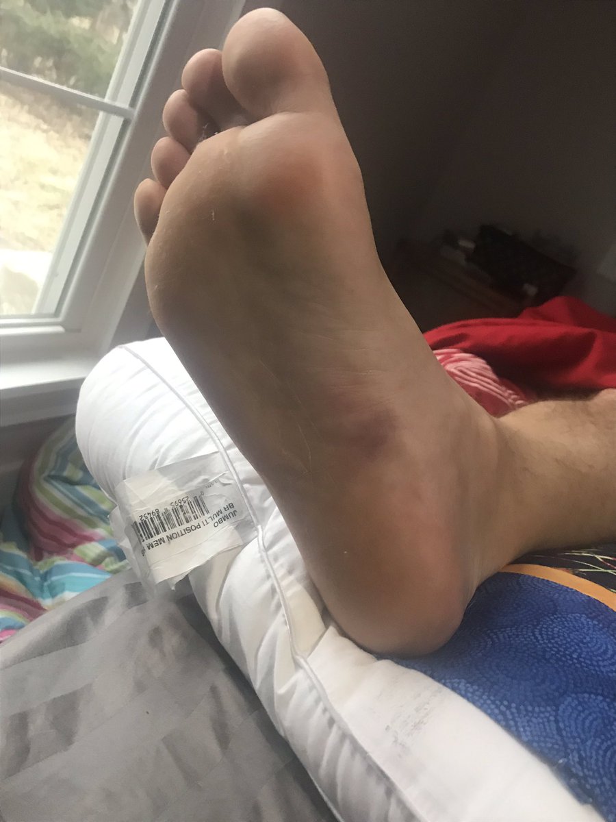 WittLaxCoach's tweet image. You know you are middle aged when you partially tear your planar  fascia coaching. . . . #bootforme