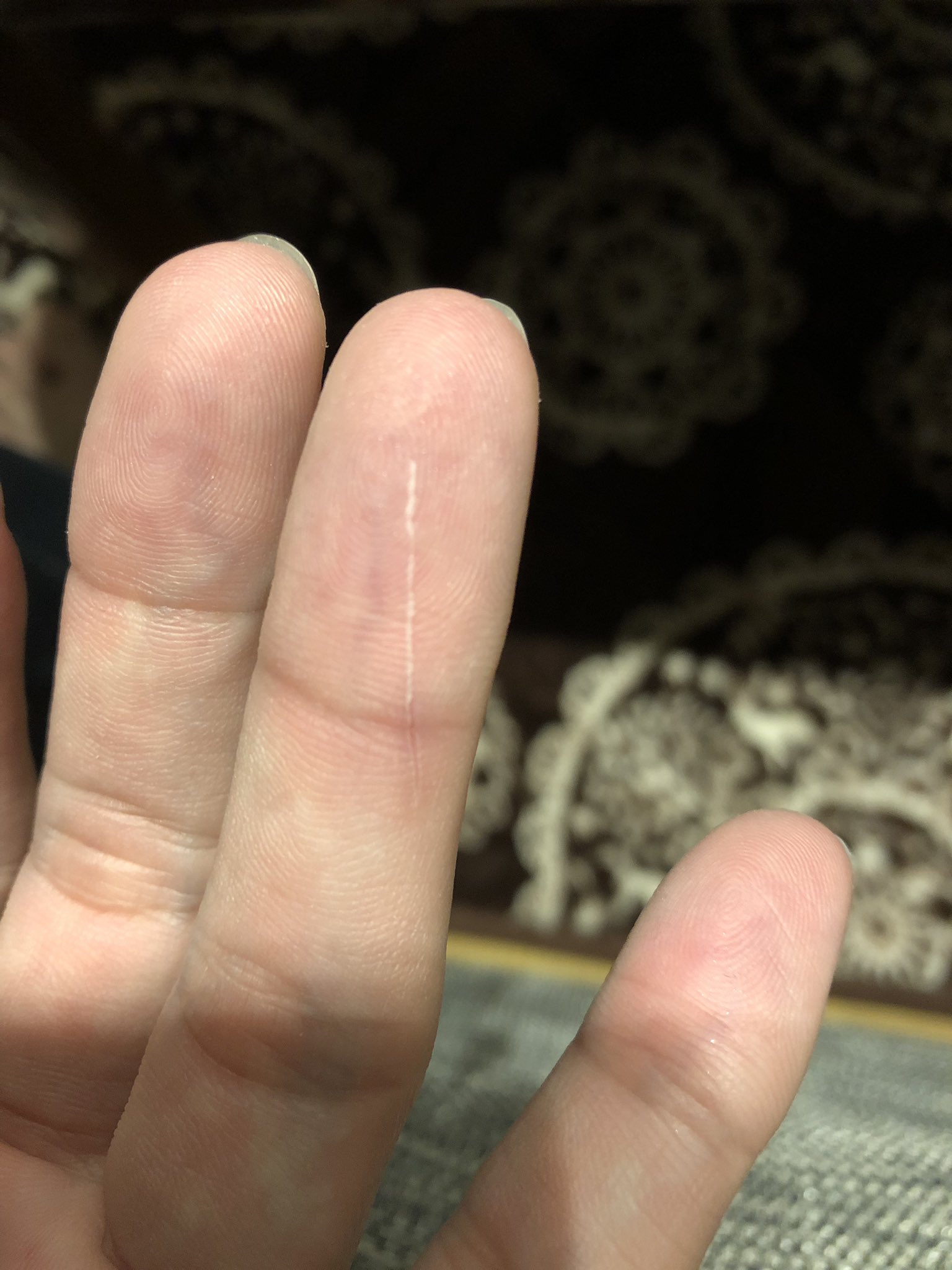 S0rl 知らんまに切れよったなかなかの範囲笑 すぱっといっとるね 血は出んけど痛いがな まったく心あたりないけど かまいたち現象みたいにゆうらしーな S0rl 知らんまに切れよったなかなかの範囲笑 すぱっといっとるね 血は出んけど痛いがな まったく心あたりないけど かまいたち現象みたいにゆうらしーな