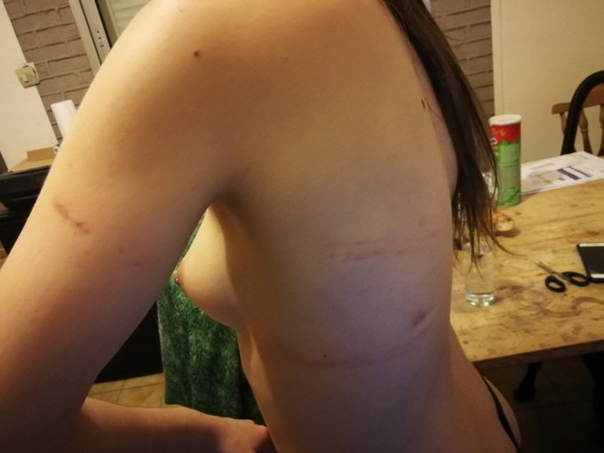 Les petits souvenirs du #shibari d'aujourd'hui 😅😅😅 https://t.co/m4VVIAzdir<a href="/tag/shibari"class="tags">#shibari</a>