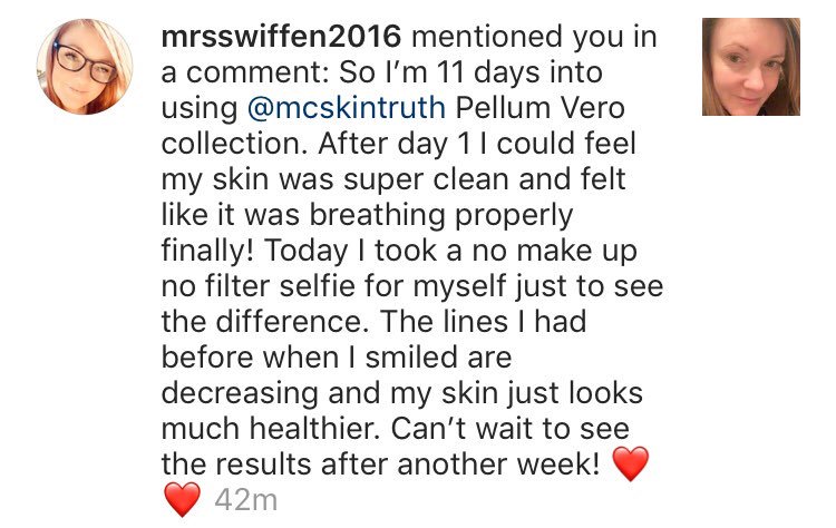 MCSkinTruth's tweet image. Another fantastic review! 😍