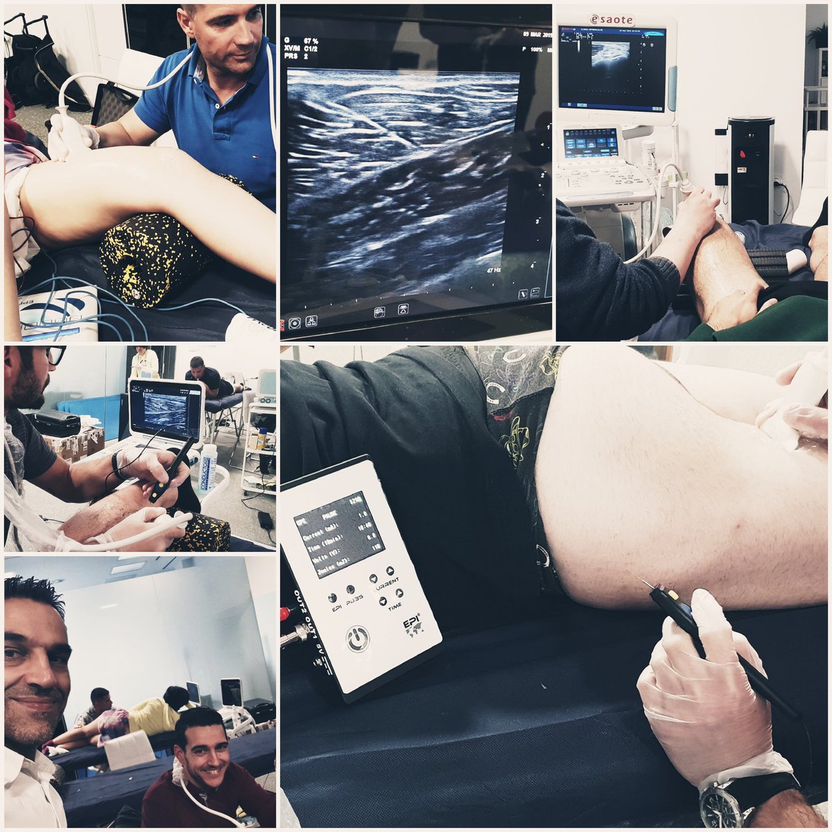 sergioserranoca's tweet photo. Finalizado el 4° Módulo del Posgrado de Fisioterapia Invasiva en Sevilla - Terapia #EPI en lesiones musculares. Gran nivel de los alumnos. @EPI_Advanced @CursosTheraform @sergioserranoca @MetropolSalud 
#isquiotibiales #aductores #cuadriceps #tricepssural #bicepsbraquial https://t.co/UQI0TKB3qS