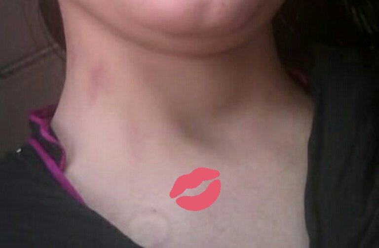 Sirf_Yaadein's tweet photo. 💋
Mere Jisam Par Tere Honton ki Nishan 💋 😘
#Sheeza #Hiba #Shaila #HinaNoor
Ham Kbi Alag ni hon Ge Promise
Laying on Chest And tears 😢 falls
Pagl #SheezaKhan https://t.co/QsmwlChpog
#SabKuchKhatamHoGya https://t.co/7QucLfvwt6