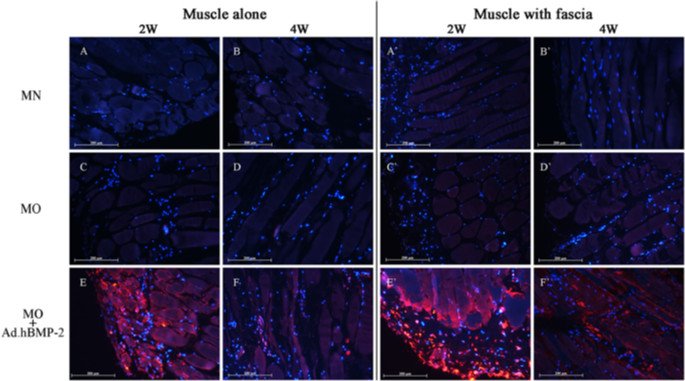 GeneTherapy_SN's tweet image. Tissue culture models of muscle implants benefit from the fascia layer by the improved delivery of BMP-2. This could help to optimize the osteo-regenerative tissue grafts &amp;amp; contribute to the development of gene-enhanced #boneengineering technologies.
ow.ly/ZtiY50mFEu5