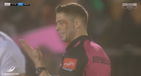 Video: Is this an <a href="/WorldRugby/">World Rugby</a> first? Referee blood bin - Nika Amashukeli of <a href="/GeorgianRugby/">Georgian Rugby</a> gets clattered, subbed, stitched up and comes back on! #rugbyunited #HardRef #Refteam rugbyreferee.net/2019/03/11/ref…