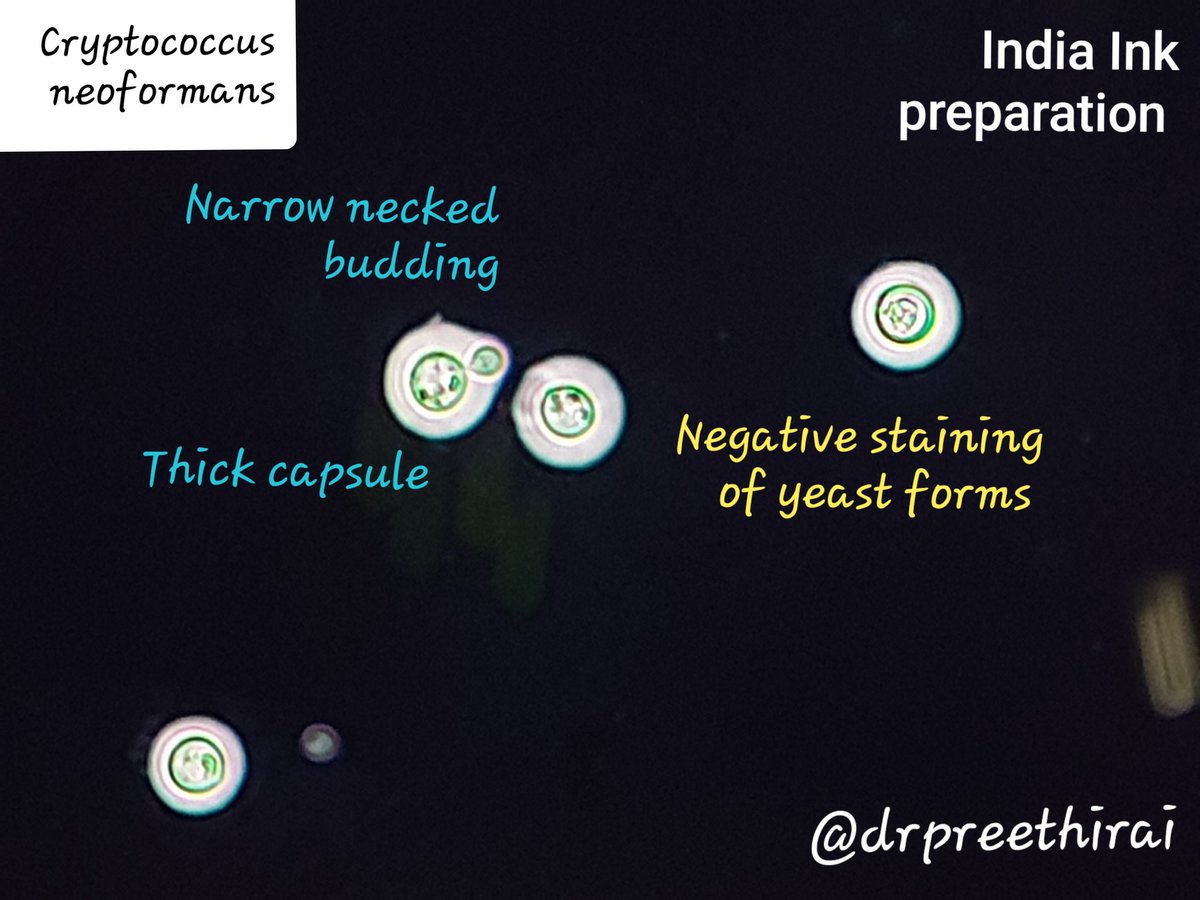Sanjay Mukhopadhyay on Twitter "6/ I thought Crouton cells were the