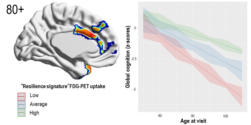 Approximately 50% of adults over 80 with significant Alzheimer’s disease pathology show normal cognition. Arenaza-Urquijo et al. identify a brain metabolic ´resilience signature´ in cognitively stable 80-plus adults. bit.ly/2UyexUI