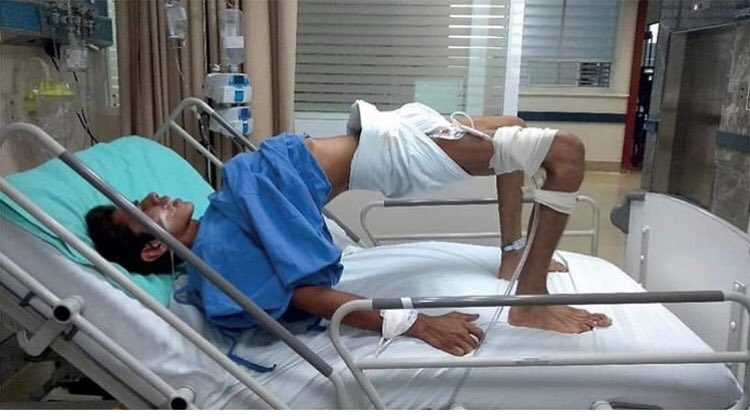 Bunun adı opistotonus. Nasıl bir şey olduğu son dönemlere kadar sadece kitaplarda, tarihi fotoğraflarda görülüyordu. Ne kadar dehşet verici olduğunu da yaşamadan bilemezsiniz. Bu vaka ise ABD’de görülmüş, 30 yıl sonra. Sebebi basit; aşı karşıtlığı. Tetanoz.