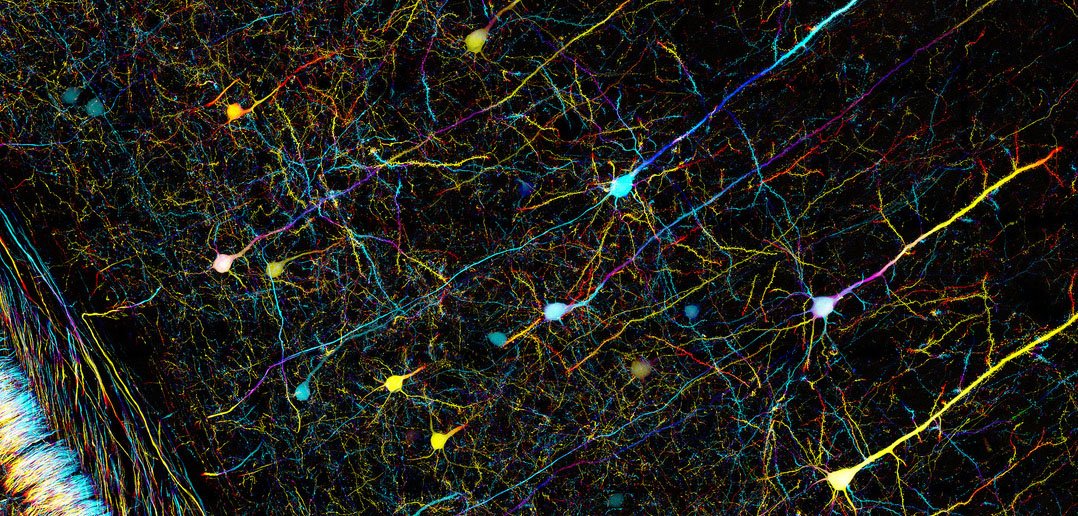 SprintStd's tweet photo. 86 miliardi di Neuroni in circa 1230cm cubi!

#BrainAwarenessWeek #brainweek2019 #scienza #11demarzo #SettimanadelCervello #sprintstudio https://t.co/PUMlO9IJRR
