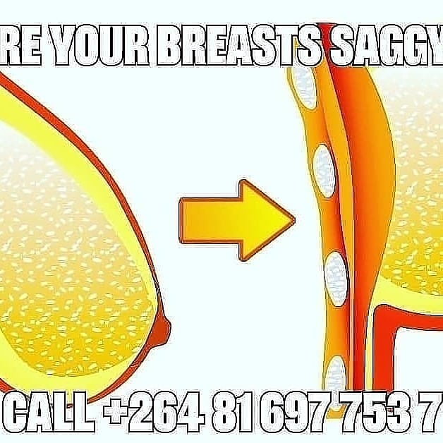 malcolmdavid888's tweet photo. Over 90% satisfactory rating! 
Join our WhatsApp Group for more information on the URL link below. 
https://t.co/QUWaE1qQ6i

#acne #eyebags #breastenlargment #saggybreasts #academicperformance #feelyoungagain  #cocroachinfestationcure #ingrownhair #dogprotection https://t.co/903od4DwWO