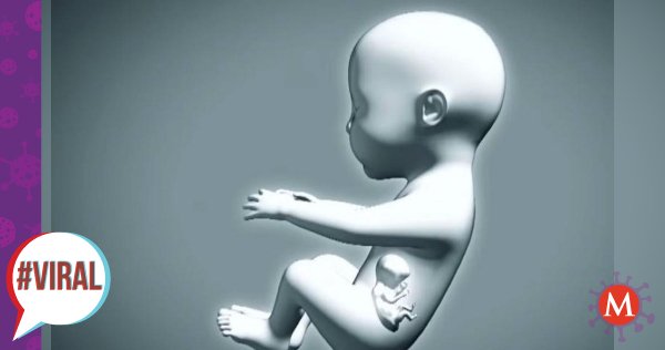 Milenio's tweet image. Bebé nace &apos;embarazada&apos; de su hermano gemelo en #Colombia mile.io/2W70SEr