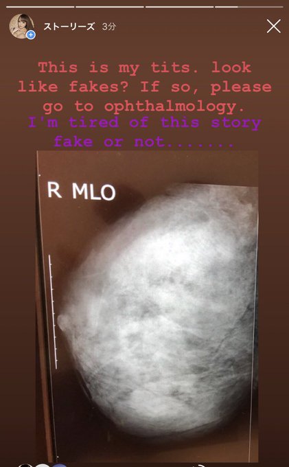 🙄 もう飽きた https://t.co/5sYTR9OsFv<a href="/tag/la"class="tags"><span>#la</span></a><a href="/tag/shoot"class="tags"><span>#shoot</span></a><a href="/tag/march"class="tags"><span>#march</span></a><a href="/tag/scoreland"class="tags"><span>#scoreland</span></a>