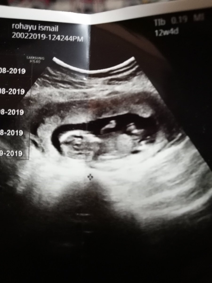 miszzayue2's tweet photo. 2nd is coming.. wafiq umar dah jd abang.. 😍 https://t.co/G4qm5ThMCf