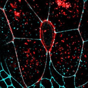 LOptics2019's tweet photo. Letting Go: How dying cells detach from their neighbours https://t.co/3pTeuN7SsQ https://t.co/TFxaoe1Z49