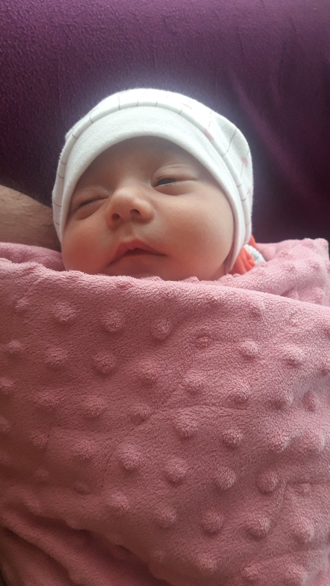 kacsaatolduson's tweet photo. Bu bebek 18 günlük, doğduğunda gözleri görmüyormuş ameliyatla düzelir denmiş. Baba işsiz, ön kontrol için bu işin uzmanı doktor aranıyor. Elden ele yayalım https://t.co/7FWG0sdsH5