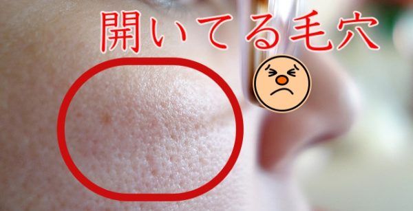 ポツポツ 毛穴 鼻の毛穴のポツポツが改善！３つのケア方法とは？