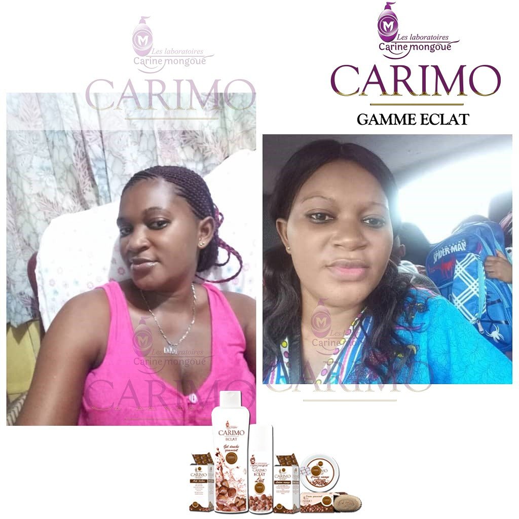 labocarimo's tweet photo. Rayonnez d'éclat avec les produits CARIMO et laissez votre entourage vous inonder de compliments.
Chez CARIMO chacun trouve son compte
Cliente satisfaite des produits CARIMO.
CARIMO,l'audace d'être soi!
#LCM #CARIMO #GETADDICTED
Yaoundé : 695142644 / 675130130.
Douala : 690500400 https://t.co/bC7j01oLfS
