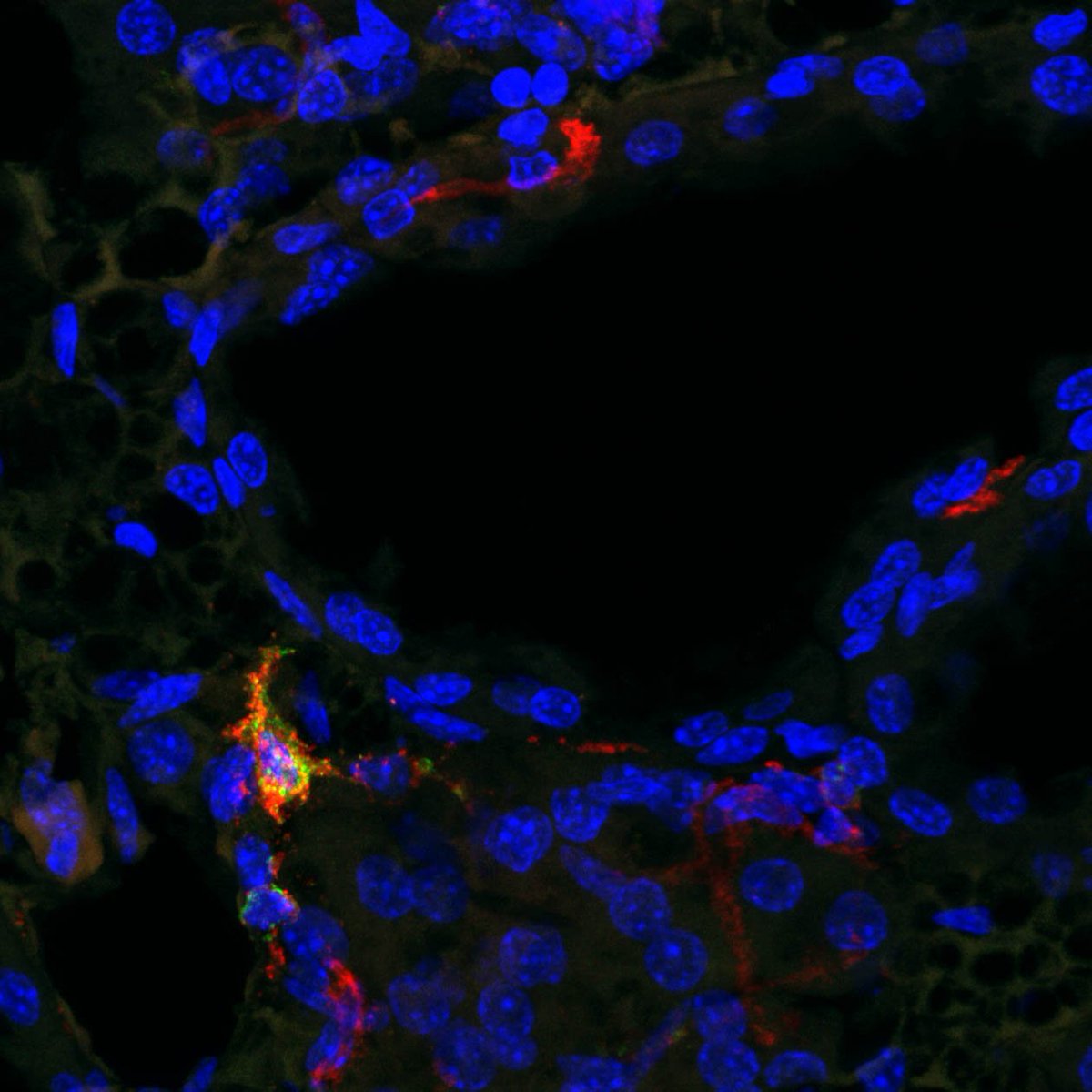 biocompare's tweet photo. Want a good #antibody for direct staining of the #CD206 epitope? A research fellow at MSKCC recommends this @BioRad product. https://t.co/3Bb5cTFPwL https://t.co/NHy5d5991n