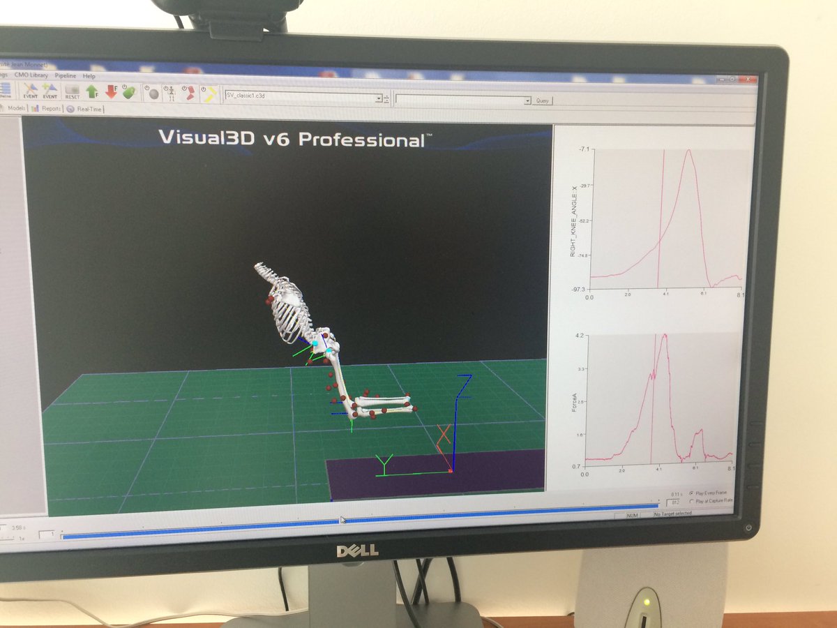 JrossiUJM's tweet image. #LIBM @Univ_St_Etienne Amazing in @IRMIS_StEtienne lab 👨‍🏫🏃‍♀️➡️💻📃
