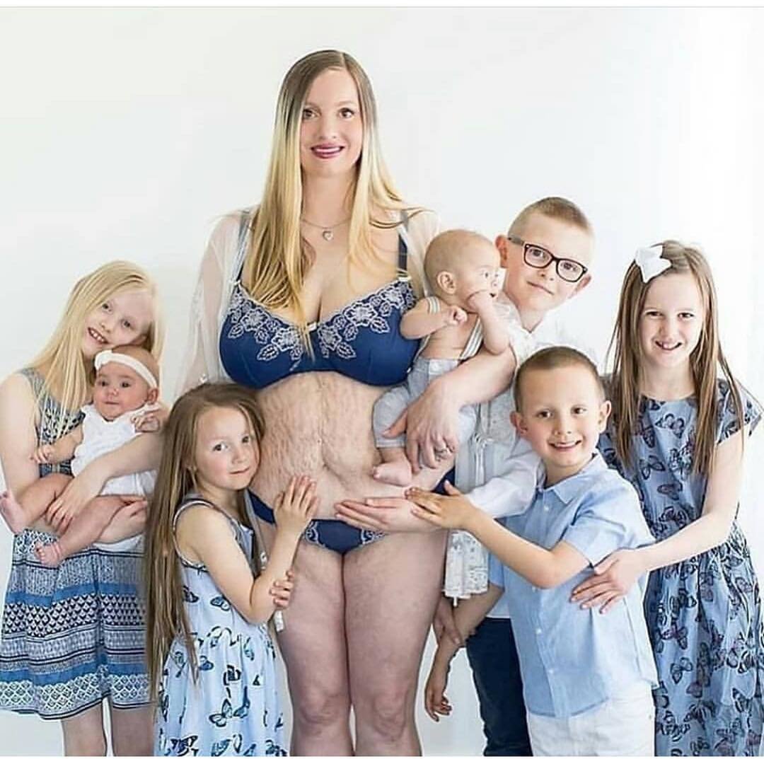 Telemetro's tweet photo. Sin complejos y sin prejuicios, esta hermosa dama muestra el mundo sus marcas de vidas, las cuales trajeron al mundo a 7 bellos retoños 👏👏 vamos a inundar este post con muchos ❤❤❤❤❤❤❤❤❤❤❤❤❤❤ #Mamá #Vida #SinComplejo https://t.co/7zjKy8hxfL