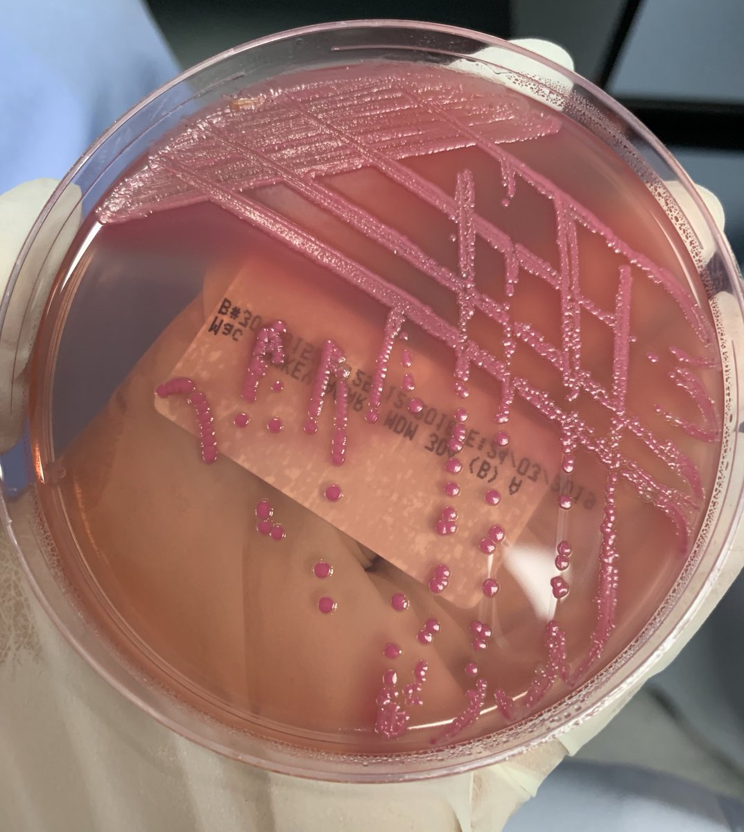 صورة اليوم من لاب المايكرو 🥁✨
-طبق الMacConkey الي هوا أصلًا مخصص لنمو ال gram - bacteria. 
- يفرق لنا بين lactose fermenting ويكون لونها pink زي الي ف الصورة💓
عن ال non lactose fermenting الي تكون colorless or pale.