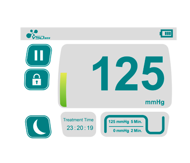 VSDMedical's tweet photo. We proudly present the series posts #10ThingsUNeedToKnowAboutVSDSTART from today! No.1: Intelligent Pressure Monitoring &amp; Control: real-time pressure is precisely monitored and displayed on screen, and is automatically calibrated to the preset value when minor fluctuation occurs. https://t.co/jAUa341AJo